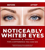
              Gouttes Oculaires Clear Eyes Maximum Redness 0.5 Fl Oz
            