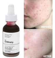 
              The Ordinary Direct Acids AHA 30% + BHA 2% Peeling Solution 30mL
            